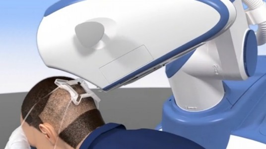 زراعة الشعر في تركيا