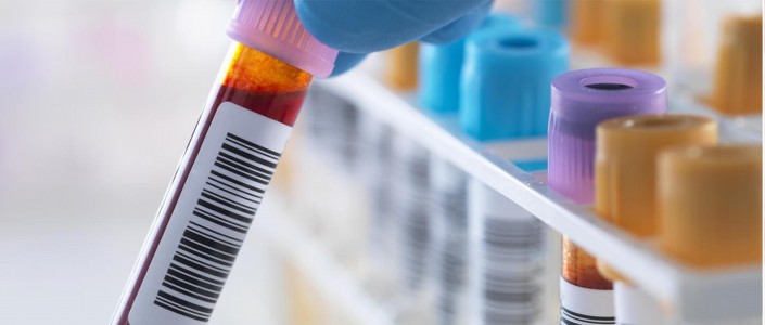 ما هو الفحص السريع لفيروس كورونا الجديد ؟؟