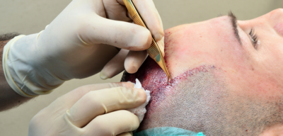 فوائد المانجو للوجه