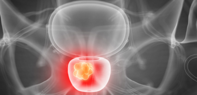 اطعمة تقي خطر الاصابة بالزهايمر