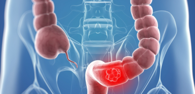 فوائد الجزر للشعر