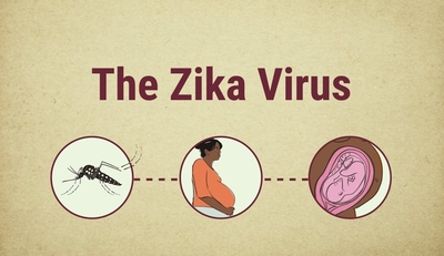 العلاقة بين الإكثار من الأكل والتوتر خلال فترة الحجر الصحي