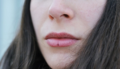 فوائد التوت الاحمر