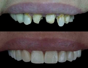 د. دينا نزال اخصائي في طب اسنان