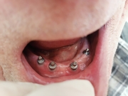 الدكتور رولا عرفات اخصائي في طب اسنان