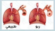 د. تامر عوض اخصائي في صدرية